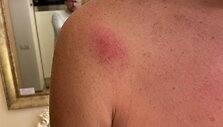 Paspirtuko vairuotojo konflikto su policijos pareigūnais padariniai