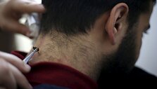 Bičių įgėlimų terapija Palestinoje gydomi pacientai