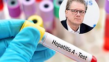 Hepatitas A, Saulius Čaplinskas