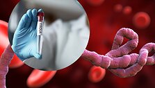 Ebola