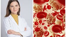 Gyd. hematologė Rūta Sema&scaron;kevičienė ir asociatyvi nuotr. 