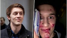 Sumu&scaron;tas Rusijos opozicijos tinklara&scaron;tininkas J.Žukovas
