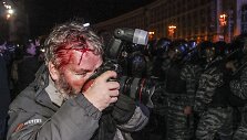 Sužeistas fotografas