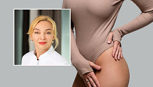 Gydytoja dermatovenerologė Eglė Auk&scaron;tuolienė kalba apie strijas