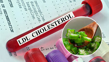 Maisto produktai, kurie mažina cholesterolio kiekį