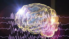 Epilepsijos priepuolis