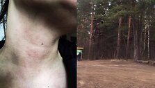 Nepilnametis užpuolė merginą Tauragės mi&scaron;ke
