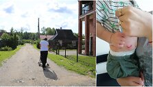 Kauno rajone &scaron;uo užpuolė pusantrų metų vaiką