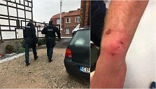 Kaunietis teigia, kad policijos pareigūnai prie&scaron; jį neteisėtai panaudojo jėgą