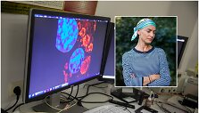 NVI Genetinės diagnostikos laboratorija / Vėžys (asociatyvinė nuotr.)