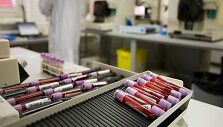 WADA paskelbtos i&scaron;vados neatitinka tikrovės