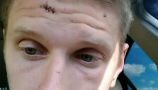 Su 15min redakcija dėl &bdquo;Aro&ldquo; operacijos susisiekęs vilnietis 