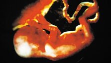 &Scaron;iaurės Dakota tapo pirmąja Amerikos valstija, pradėjusia įstatymo, kuriuo nustatoma, kad žmogaus &bdquo;asmenybė&ldquo; prasideda nuo apvaisinimo momento, priėmimo procesą.