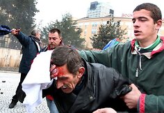 Protesto akcija Tiranoje virto kruvinomis kautynėmis.
