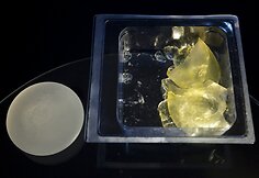 Nepanaudotas krūtų implantas (kairėje) ir po 8 metų i&scaron;imti krūtų implantai (de&scaron;inėje)