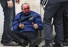 Sužeistas protestuotojas