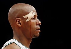 Ray Allenas prakirstu antakiu