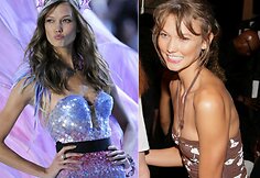Karlie Kloss