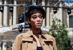 Winnie Harlow 