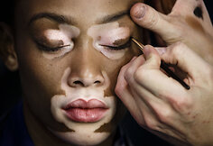 Winnie Harlow