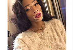 Winnie Harlow