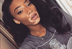 Winnie Harlow