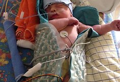 Matui reikia pagalbos, kad jis galėtų vaikščioti savarankiškai