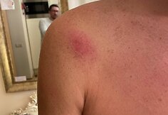 Paspirtuko vairuotojo konflikto su policijos pareigūnais padariniai