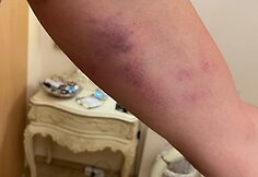 Paspirtuko vairuotojo konflikto su policijos pareigūnais padariniai