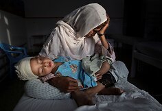 Mama laiko per sprogimą sužeistą savo sūnų Kabulo ligoninėje