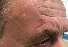 Kaunietis teigia, kad policijos pareigūnai prie&scaron; jį neteisėtai panaudojo jėgą