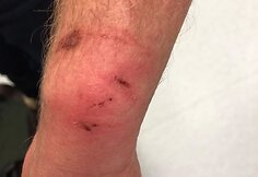 Kaunietis teigia, kad policijos pareigūnai prie&scaron; jį neteisėtai panaudojo jėgą