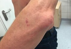 Kaunietis teigia, kad policijos pareigūnai prie&scaron; jį neteisėtai panaudojo jėgą