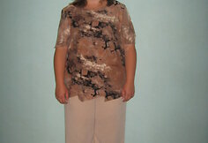 Prie&scaron; gydymą