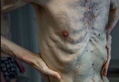 Ukrainietis Romanas Horilykas po dvejų metų, praleistų Rusijos nelaisvėje