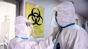Šimtai Kinijos gydytojų ir slaugytojų skutasi plikai, kad išvengtų koronaviruso
