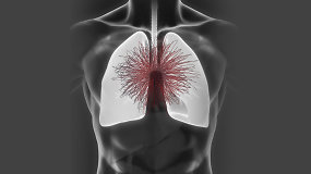 Astma – kas tai per liga ir kaip su ja kovoti?