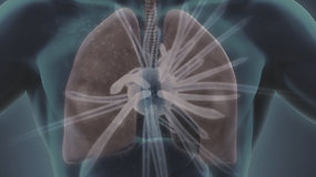 Kas yra tuberkuliozė ir kodėl ja užsikrėsti gali kiekvienas?