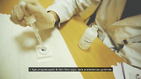 Lietuvoje ŽIV gydymas efektyvus, tačiau tik trečdalis jį gauna