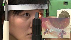 Moters akyje apsigyveno bitės – radinys sukrėtė ir gydytojus