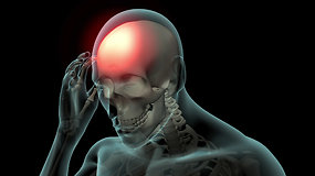 15min paaiškina: kodėl skauda galvą?