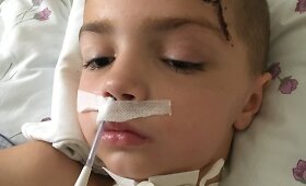 Avarijoje sunkią galvos traumą patyrusi Kotryna Remelytė