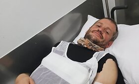 Balys Bardauskas Limos ligoninėje