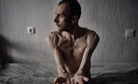 Rusų nelaisvėje buvę ukrainiečiai neteko po 40 kg svorio