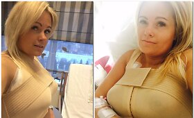 Gintarė Lisauskienė pasididino krūtinę