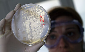 E.coli bakterijos tyrimai