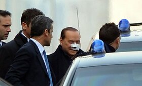 Italijos premjeras Berlusconi paliko ligoninę