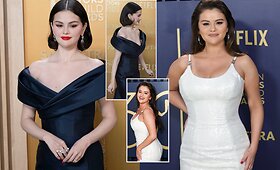 Selena Gomez nustebino pokyčiais