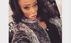Unikalios i&scaron;vaizdos modelis &ndash; Winnie Harlow