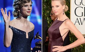 Ar grak&scaron;čioji Taylor Swift pasididino krūtinę?